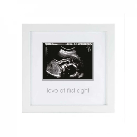 PearHead Frame Sonogram, White PearHead Frame Sonogram, White