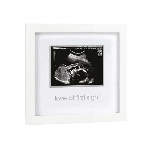 PearHead Frame Sonogram, White - بيرهيد - Image 3