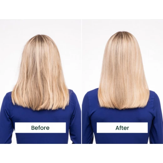 تانجل تيزر - أفضل مزيل تشابك للشعر السميك والمجعد - أزرق/أزرق - تانجل تيزر - Image 6