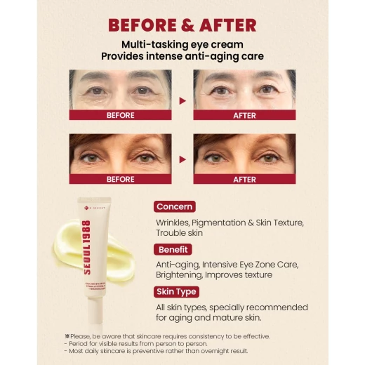 K Secret Seoul 1988 Eye Cream Retinal Liposome 4% Fermented Bean 30ml Anti-Aging - k-secret - Image 5