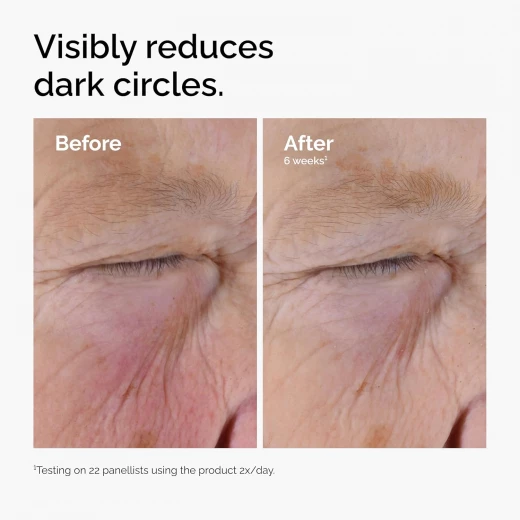 The Ordinary Caffeine Solution 5% + EGCG Eye Serum, Reduces Puffiness, Dark Circles, 1 Fl Oz - The Ordinary - Image 7