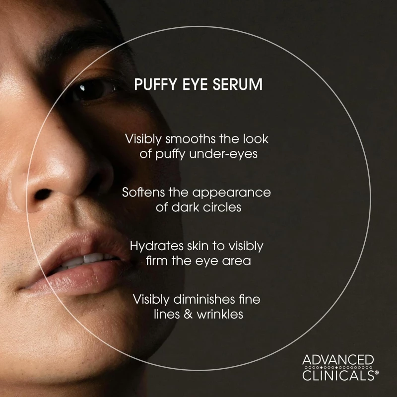Advanced Clinicals Puffy Eye Under Eye Serum | Visible Anti Aging Brightening Vitamin C + Caffeine Serum Helps Improve Look Of Puffiness, Fine Lines, Dark Circles, & Uneven Skin Tone, 1.75 Fl Oz | Beauty & Personal Care | Skin Care | Eyes | Eye Serums Advanced Clinicals Puffy Eye Under Eye Serum | Visible Anti Aging Brightening Vitamin C + Caffeine Serum Helps Improve Look Of Puffiness, Fine Lines, Dark Circles, & Uneven Skin Tone, 1.75 Fl Oz | Beauty & Personal Care | Skin Care | Eyes | Eye Serums