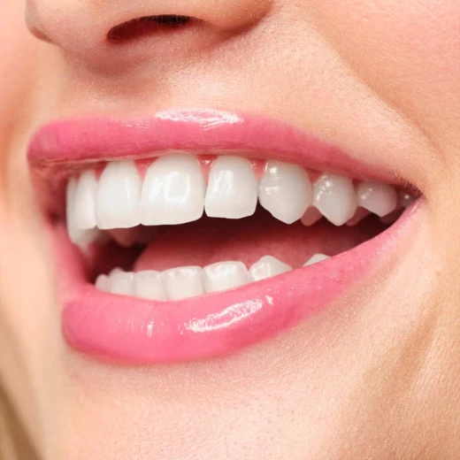 أرتديكو سائل تكثيف الشفاه بيري لامع مظهر رطب 3 مل لشفاه ممتلئة - ارتديكو - Image 5