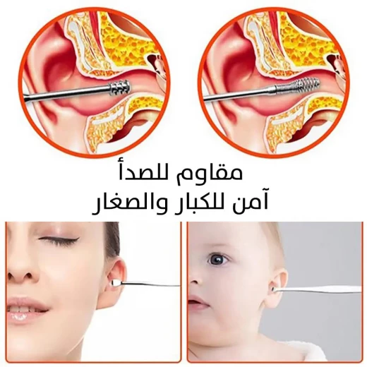 أداة إزالة شمع الأذن - تصميم ذهبي وردي للتنظيف الآمن والفعال - Image 4