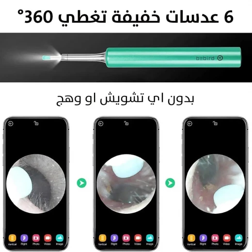 OTOSCOPE Ear Wax Removal Endoscope: Clear & Safe Ear Cleaning - Image 7