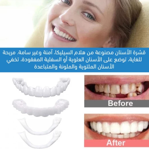طقم فينير الأسنان المثالي, تغطية كاملة علوية وسفلية لابتسامة فورية وطبيعية تعزز الثقة - Image 4