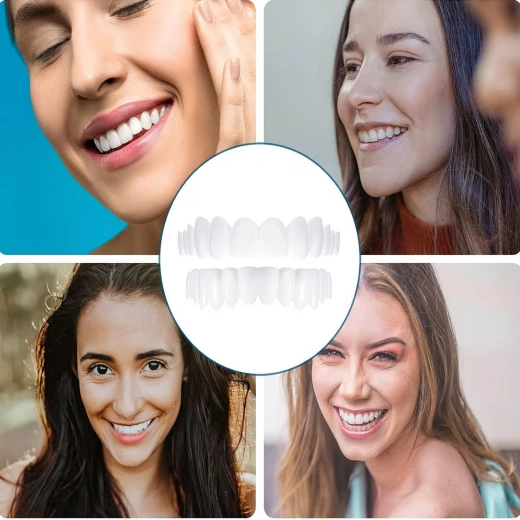 طقم فينير الأسنان المثالي, تغطية كاملة علوية وسفلية لابتسامة فورية وطبيعية تعزز الثقة - Image 6
