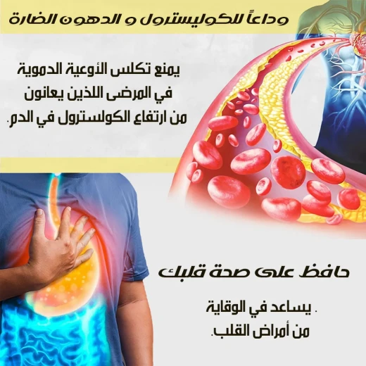 ميتا شوب خل الثوم - ميتاشوب - Image 5