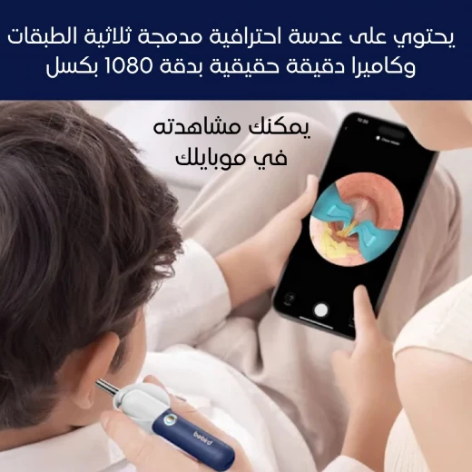 مجموعة تنظيف الأذن إيرسايت بلس D39R بكاميرا HD ,جهاز ذكي مزود بتطبيق وملعقة أذن آمنة, مناسب للكبار والأطفال من بيبيرد - بيبيرد - Image 4