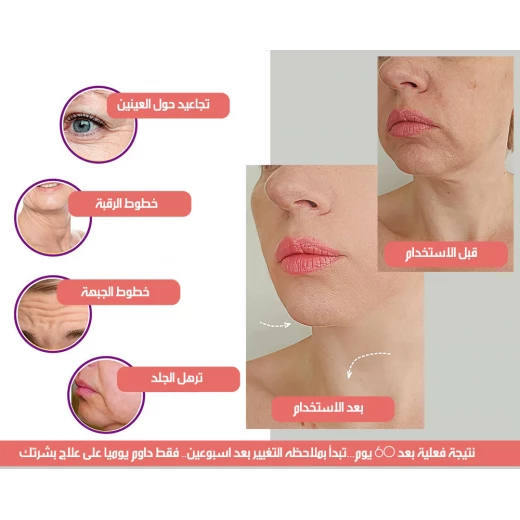 IPL Wrinkle Reduction Device Intense Pulsed Light Anti Aging Skin Care - Image 6