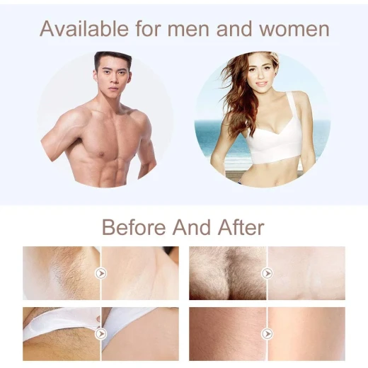 LES COLTON T009i IPL Hair Removal Device for Home Use, 300,000 Light Pulses, LCD Display, Quartz Lamp and 5 Energy Levels - Mera shopping - Image 3