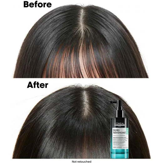 L'Oréal Professionnel |Scalp Advanced Anti-Oiliness 5 in 1 professional leave-in serum, defeats 5 scalp deregulation | SERIE EXPERT | 90ml - Loreal professionnel - Image 9
