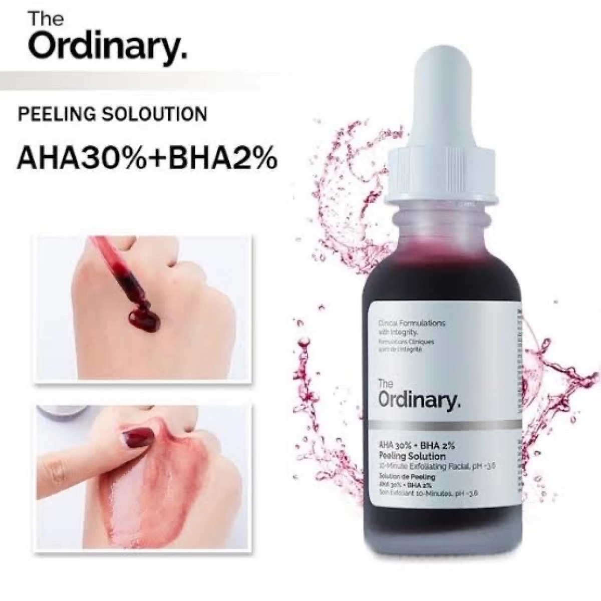 محلول التقشير The Ordinary AHA 30% + BHA 2% - 30 مل