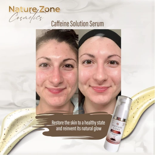 Nature Zone Revitalize Your Skin with Natural Caffeine Serum For Face & Under Eyes - Combat Acne, Dark Circles, Fine Lines, Wrinkles, Anti-Aging For Men & Women (1.06 Fl Oz) - nature zone - Image 5