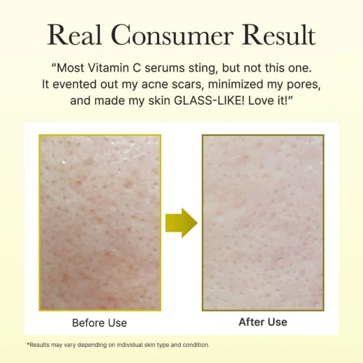 Arencia Vitamin C Booster Shot – Brightening & Firming Booster with Vitamin C Complex, Glutathione & Niacinamide – 30 mL - Arencia - Image 6
