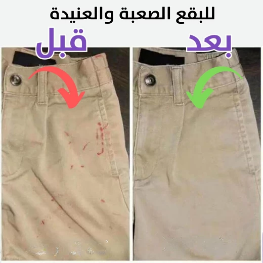 مزيل البقع عن الملابس للزيوت العنيدة بالإنزيمات النشطة - Image 3
