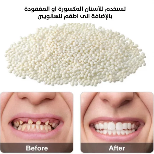 معجون حشوات الراتنج للأسنان عدد واحد - Image 4
