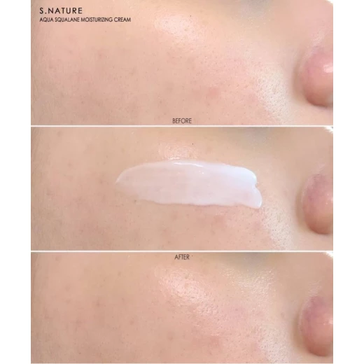 كريم S.Nature أكوا سكوالين المرطب 80 مل، كريم وجه مرطب للبشرة الجافة والحساسة - Image 3